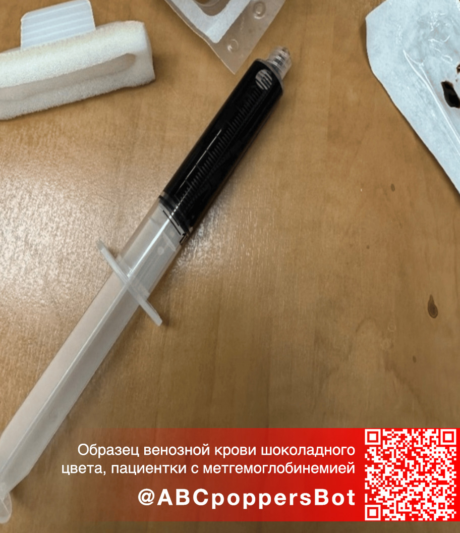 Если принять попперс внутрь в Самаре это вызывает метгемоглобинемию. Смертельное состояние Если принять попперс внутрь в Самаре это вызывает метгемоглобинемию. Смертельное состояние